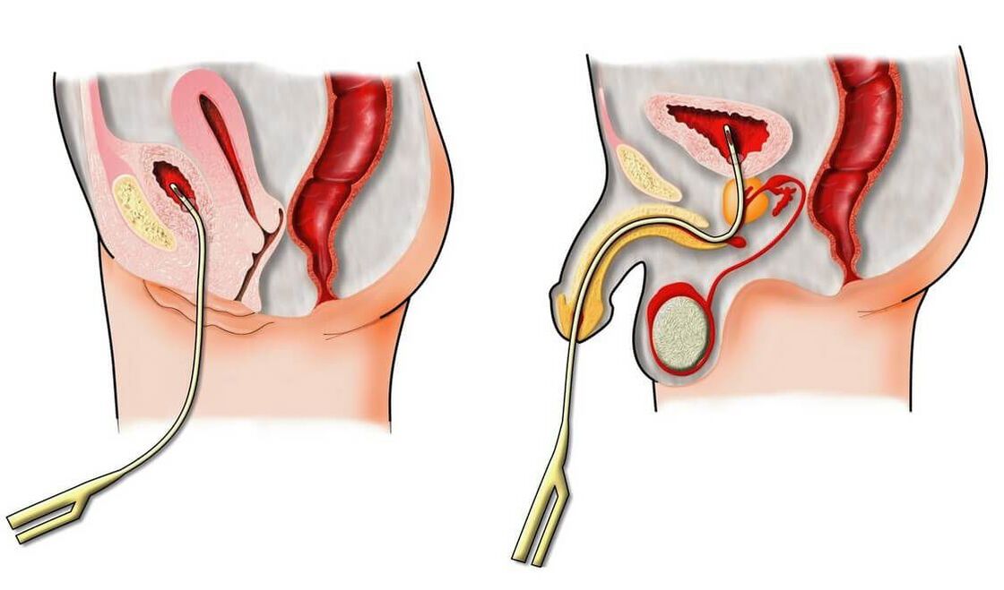 diagnosis of impotence in men